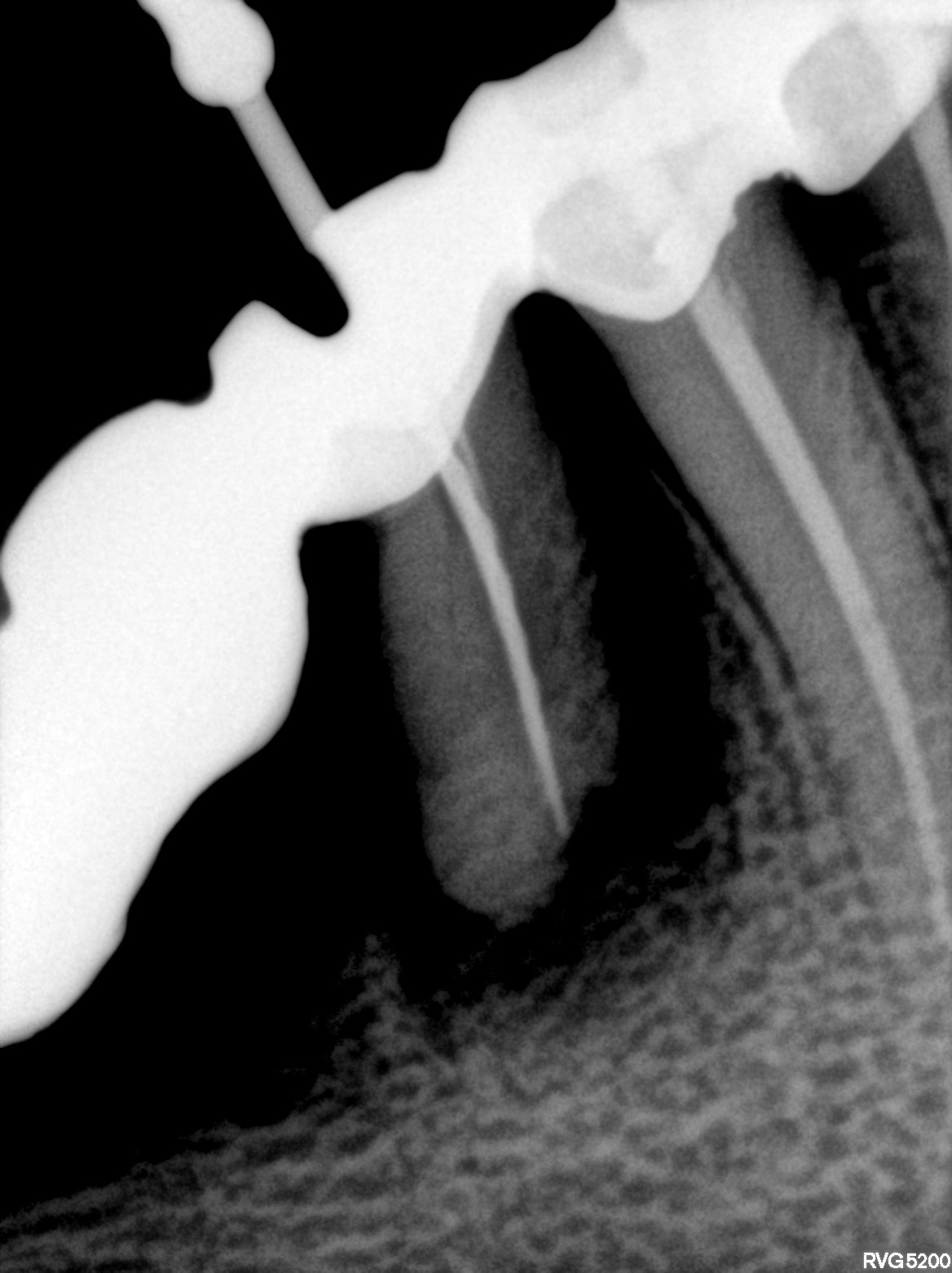 Dental X-ray